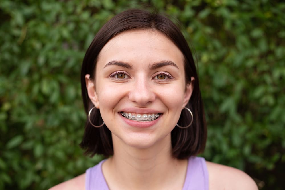 A young person with braces smiles against a leafy background. Orthodontic treatment options, including braces, may be available in Henderson, NV.