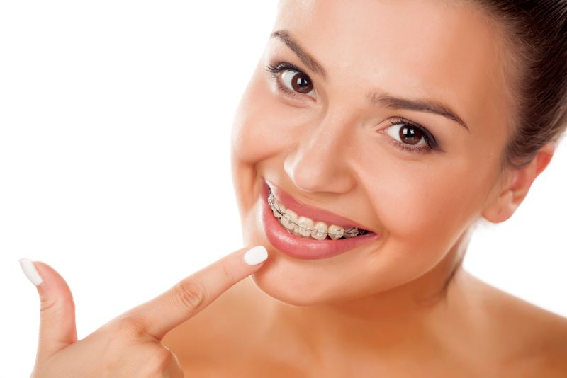 Woman smile with Clear ceramic braces at Chauncey Orthodontics in Henderson NV.